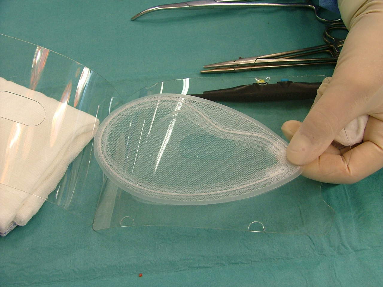 Moderní metoda operace tříselné kýly